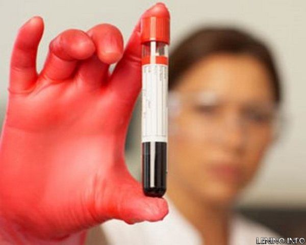 Российские ученые разработали безопасный тест на резус-фактор плода