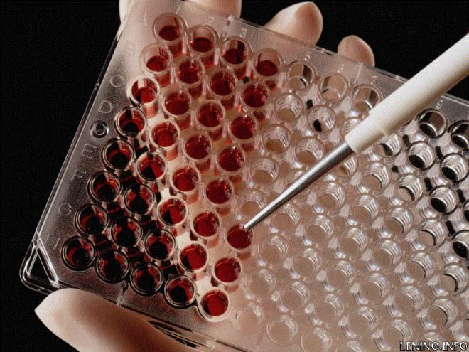 По анализу крови будут узнавать продолжительность жизни